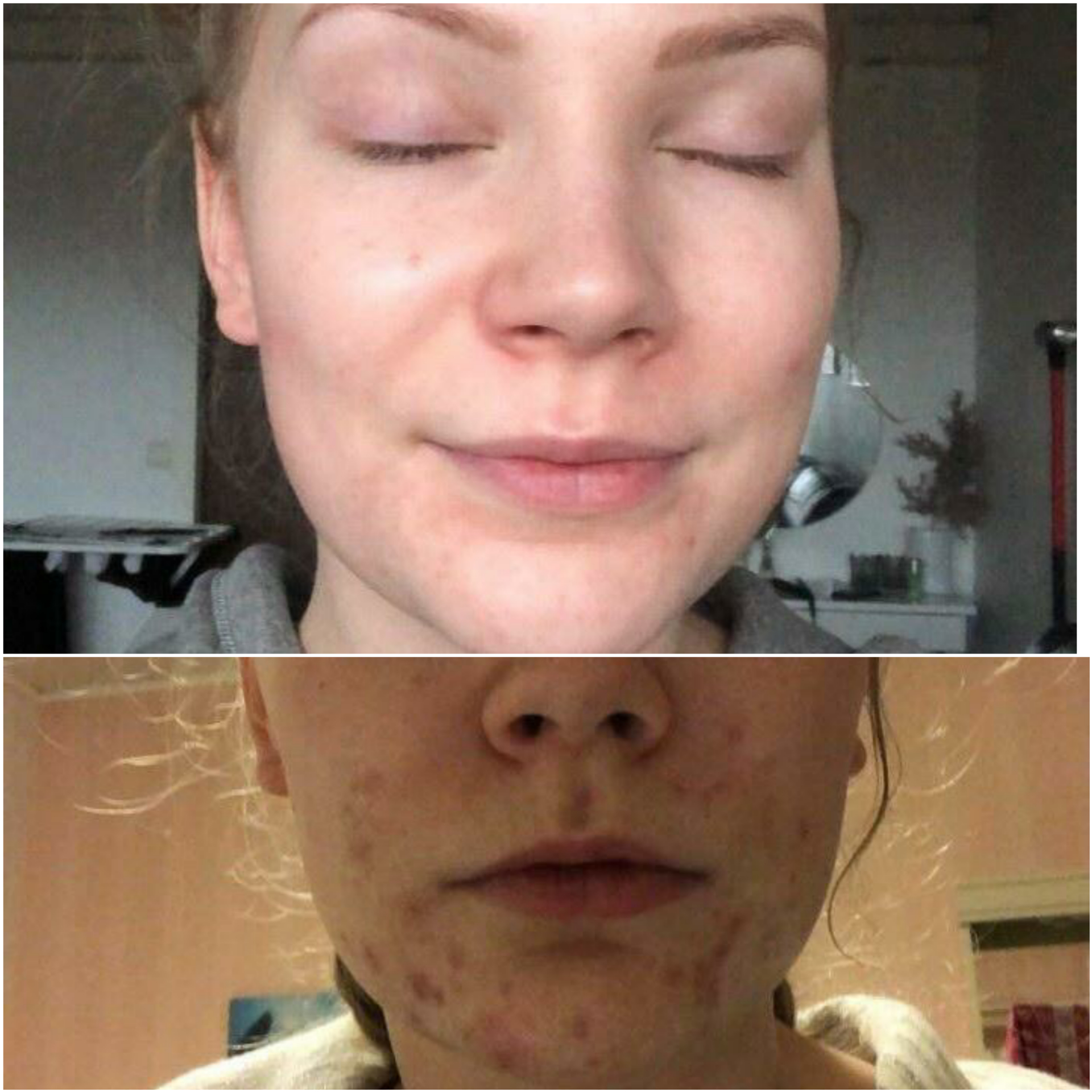 iho ennen ja jälkeen